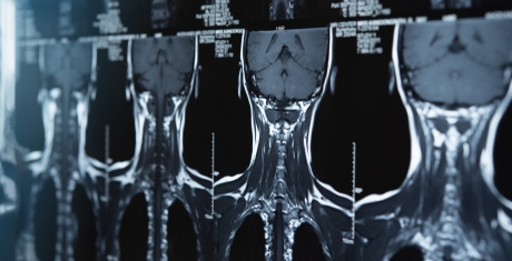 손 맞잡은 동국생명과학·인벤테라…MRI 조영제 신약 기대감↑