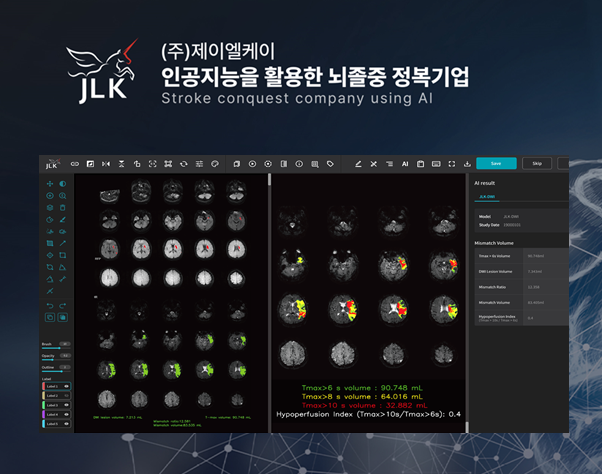 제이엘케이, KSEM 2024 참가 '뇌졸중 풀 솔루션' AI 기술력 공개